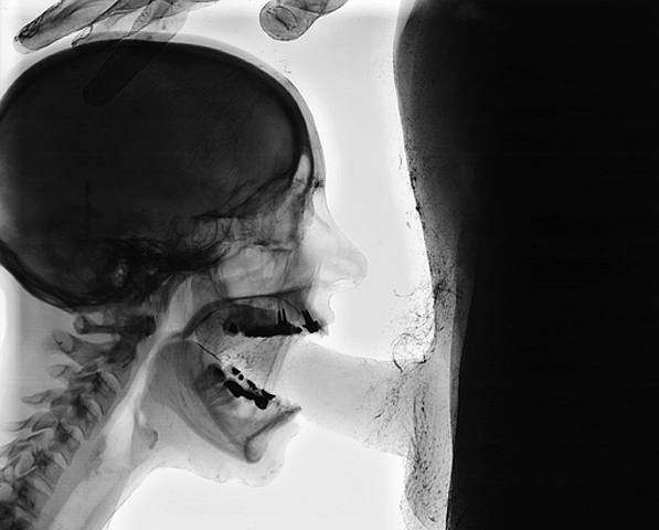 Xray Cock In Mouth 56